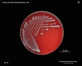 klebsiella pneumoniae mucoid colonies on blood agar